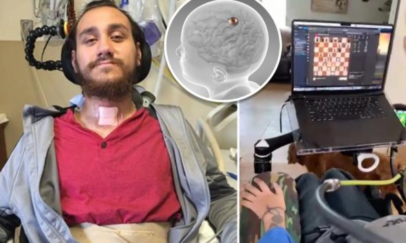 El testimonio de Noland Arbaugh paciente con el primer implante de Neuralink